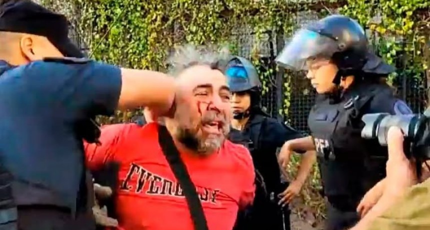 - RADIOKTUBRE INFO……..  Bullrich, entre las excusas y las justificaciones por la brutalidad policial contra un camarógrafo  …… Por Simòn Suarez.