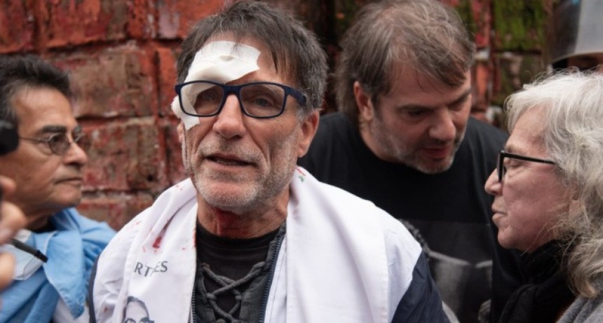RADIOKTUBRE INFO…….. COMO DECIA FRANCISCO PIDEN PAN Y LE DAN GAS PIMIENTA   …… Por Simòn Suarez