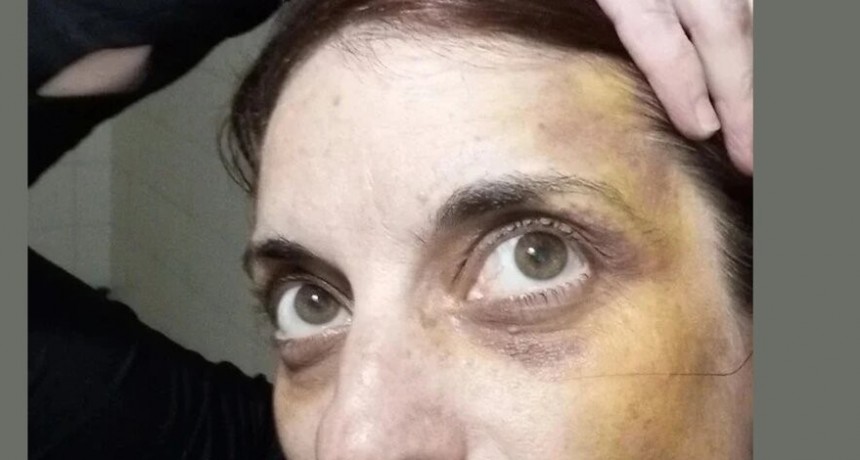  RADIOKTUBRE INFO…. JUJUY COMO FUÉ EL BRUTAL ATAQUE A LA DOCENTE CAMILA MULLER  …Por Simón Suarez..Ver mas..