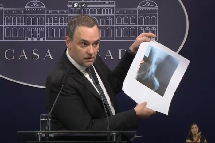RADIOKTUBRE INFO……..  Manuel Adorni: veedor y propagador de fakes news  …… Por Simòn Suarez